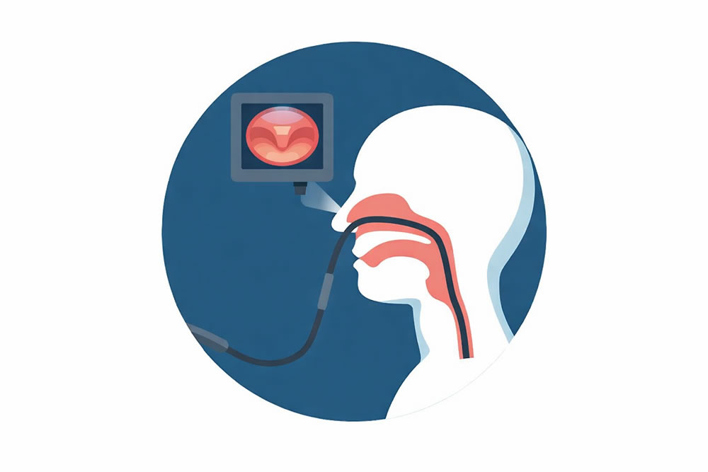 嚥下内視鏡（VE）検査