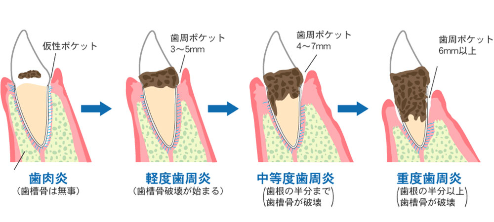 治療法