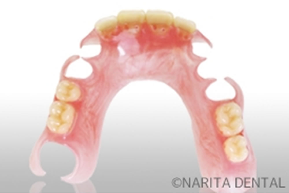 ナチュラルデンチャー