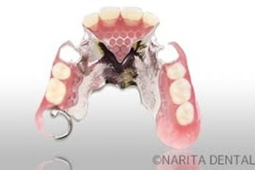 スーパーナチュラルデンチャー