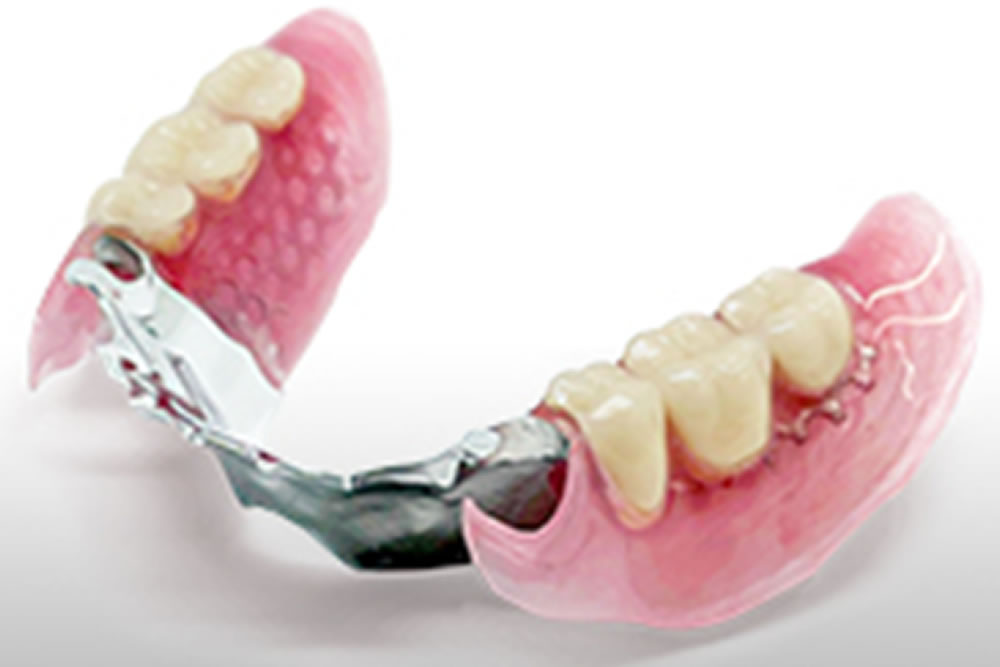 ナチュラルフィット