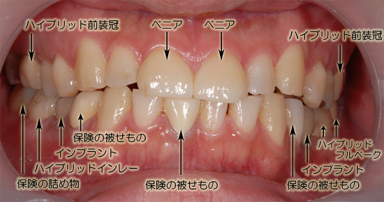 症例